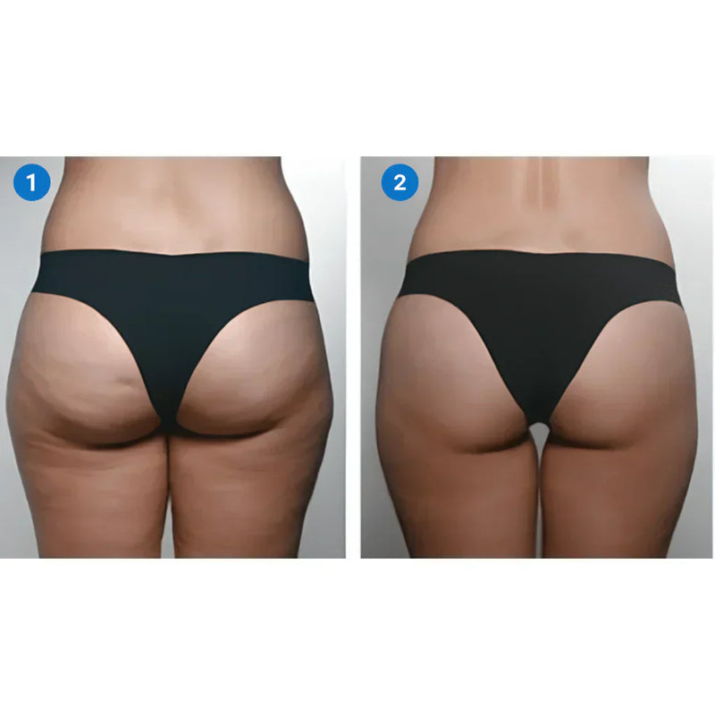 Creme de Pele Anti-Rugas e Flacidez Fubsta® PROMOÇÃO Compre 1 e Leve 2